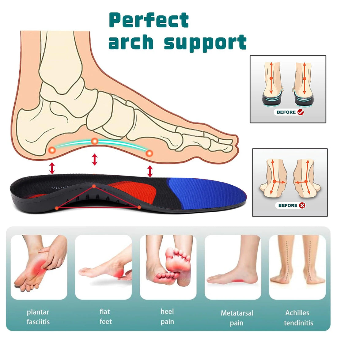 High Arch Support Orthotic Insoles