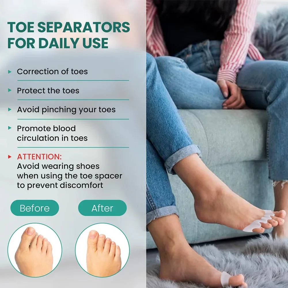 Gel Toe Separators and Protectors