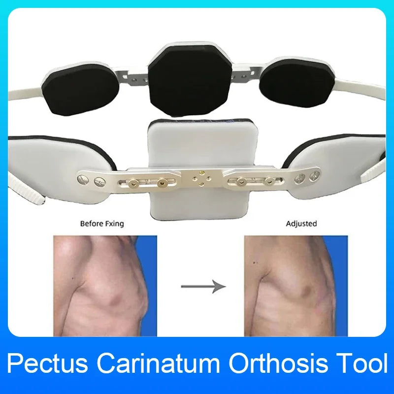 Adjustable Chest Orthosis Brace