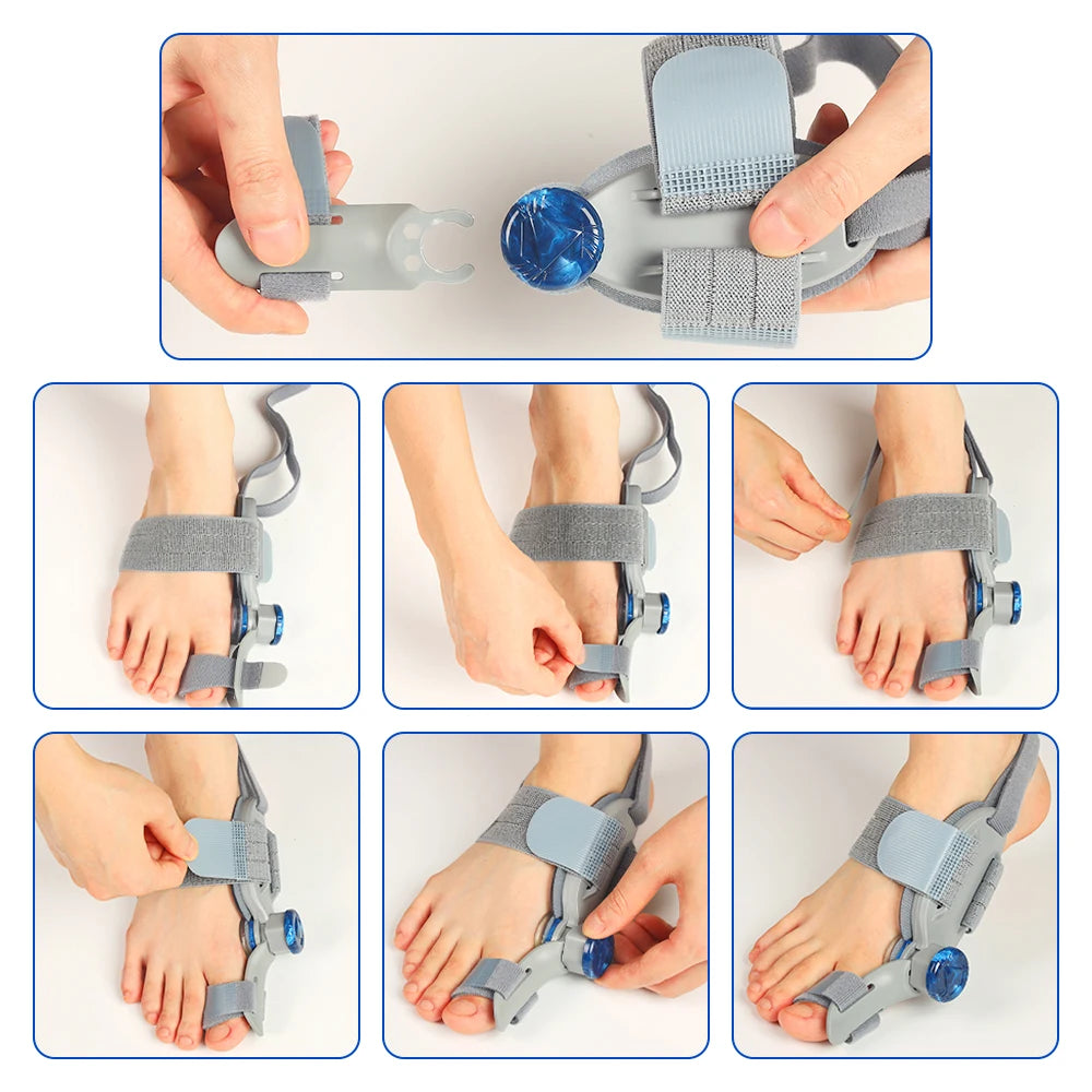 Adjustable Bunion Corrector with Toe Support
