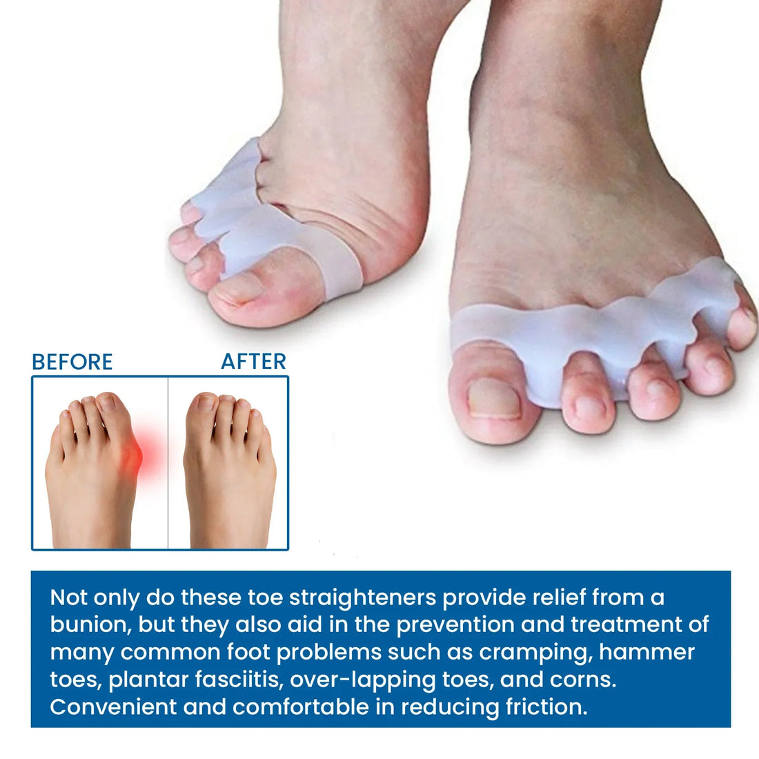 Silicone Toe Separators for Foot Care