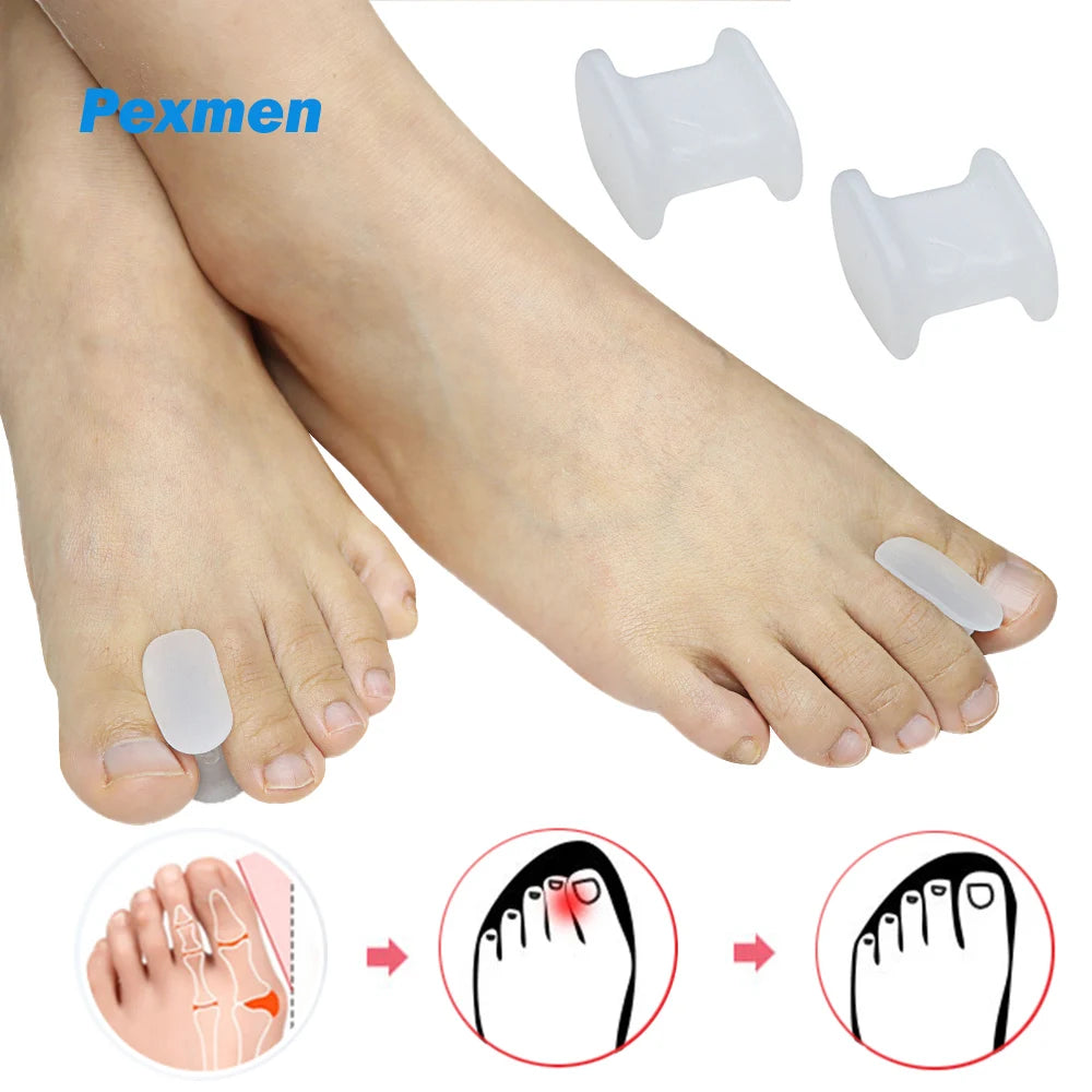Toe Spacers and Protectors for Overlapping Toes