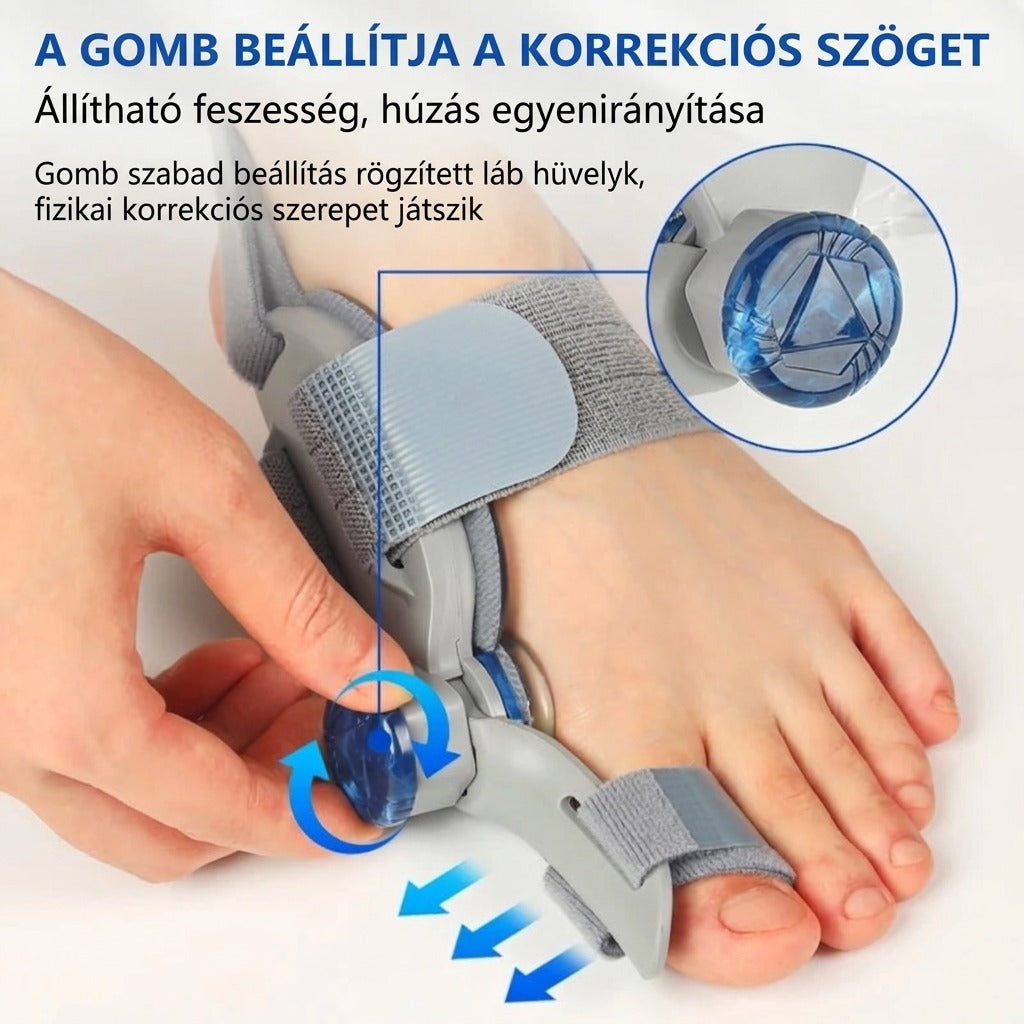Állítható nagylábujj-korrigáló elválasztóval
