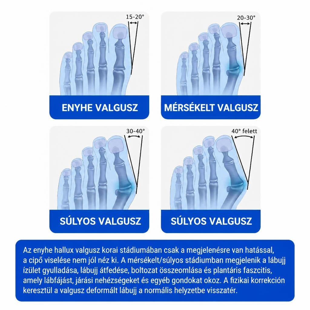 Állítható bütyökkorrigáló lábujjtámasszal