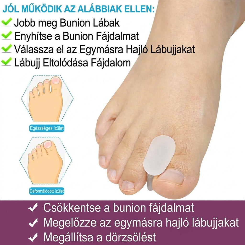 Bunion és lábújj problémák ellen: csökkentés, megelőzés, dörzsölés megállítása.