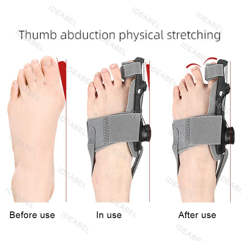 Adjustable Toe Adjuster