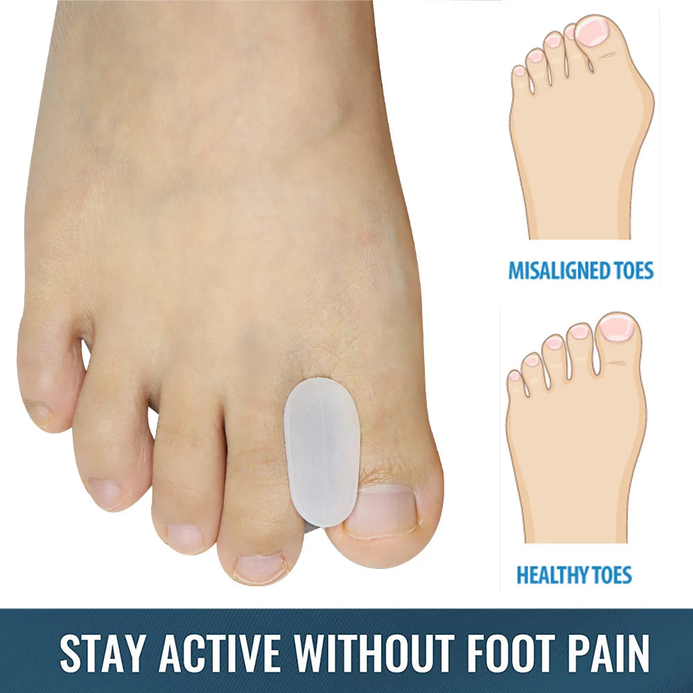 Toe Spacers and Protectors for Overlapping Toes