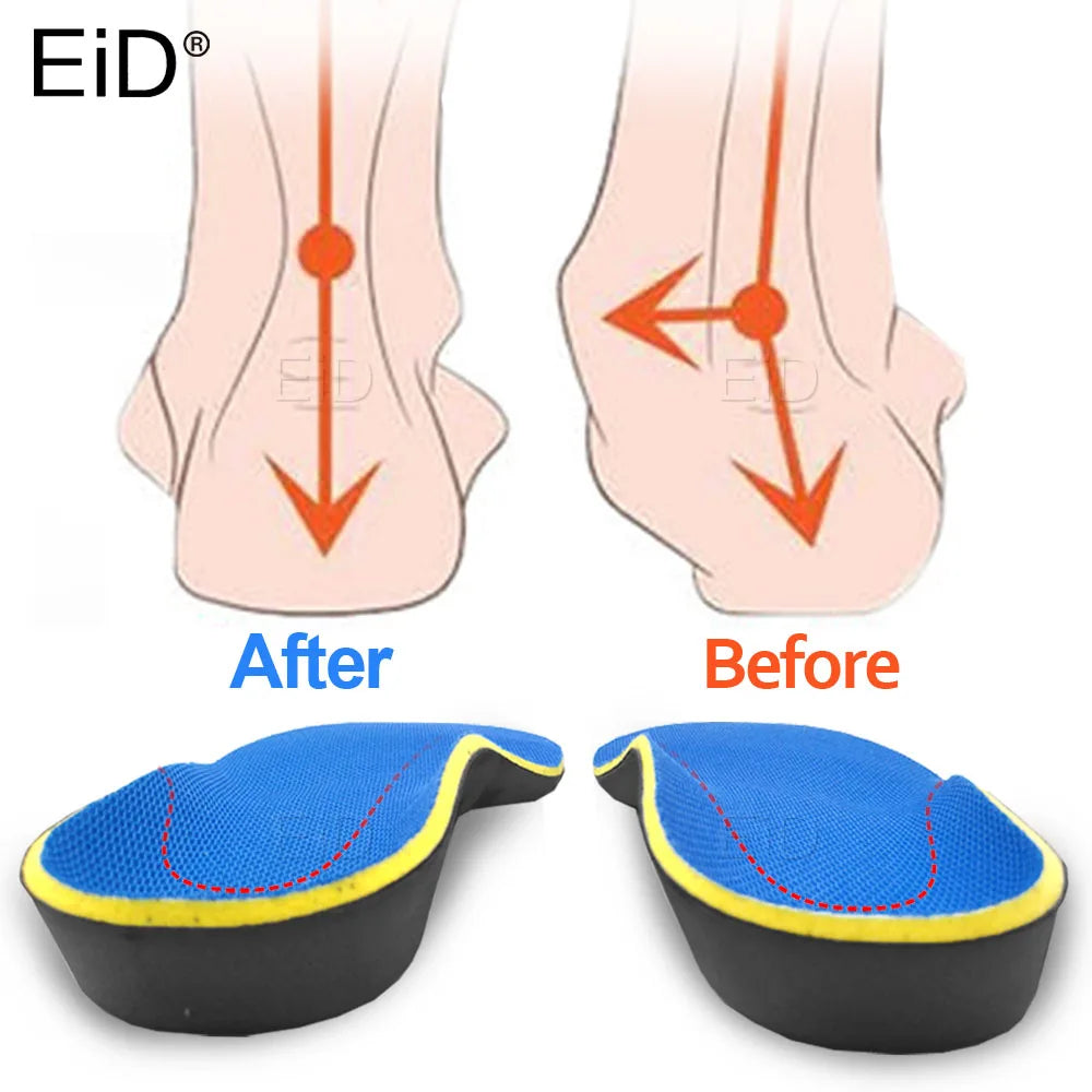 Orthotic Insoles for Arch Support