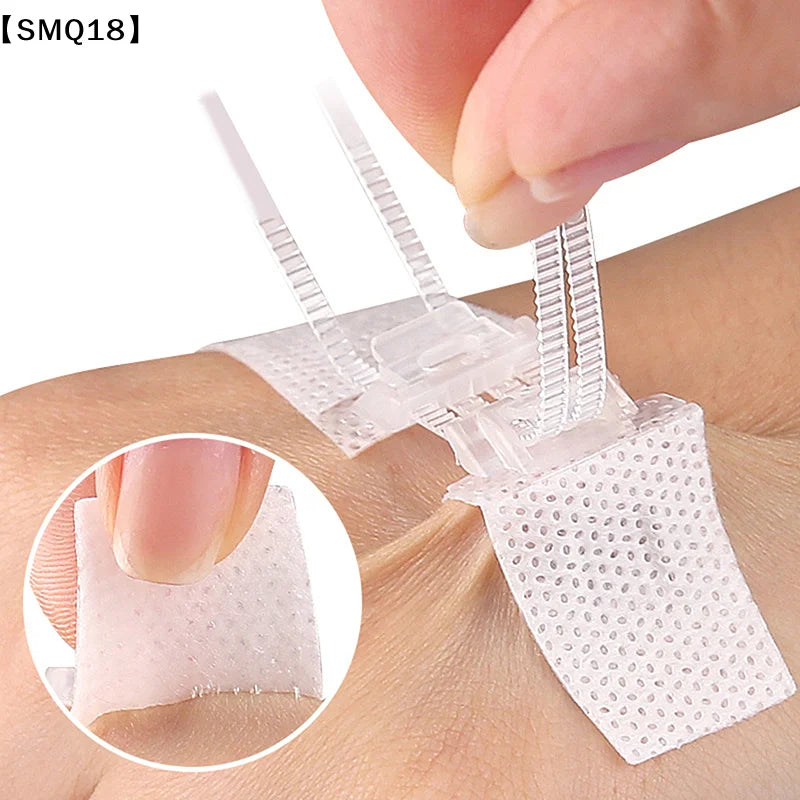 Zipper Wound Closure Patch for Minor Cuts