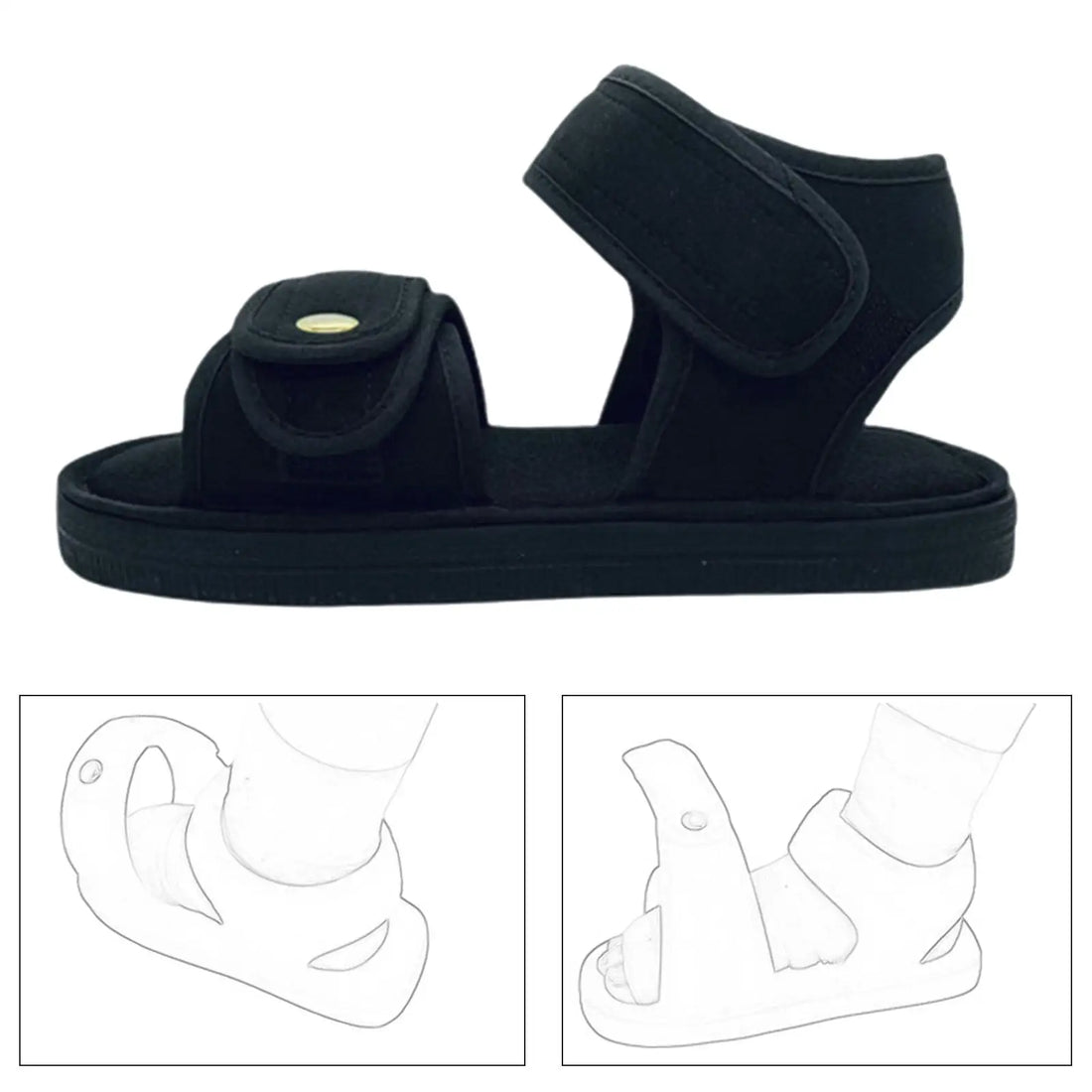 Adjustable Open-Toe Cast Shoe for Foot Injuries