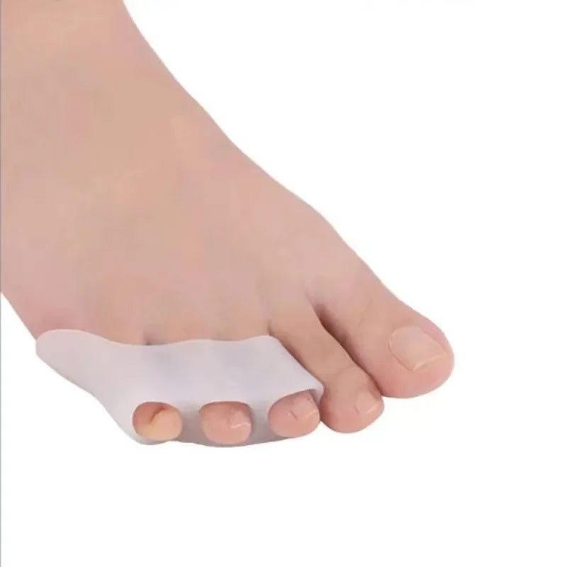 Toe Separators for Overlapping Toes