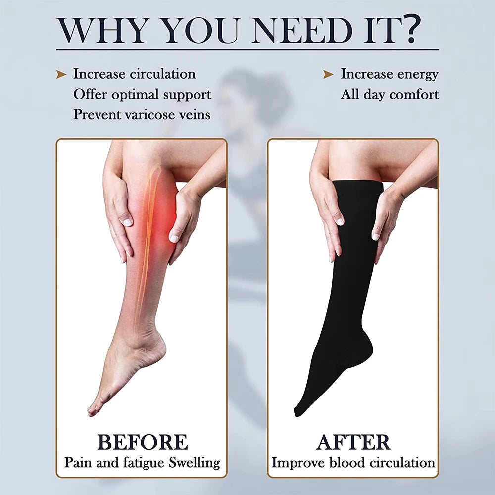 Open-Toe Calf Compression Socks S-7XL