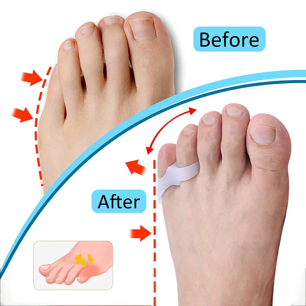 Gel Little Toe Protector and Separator