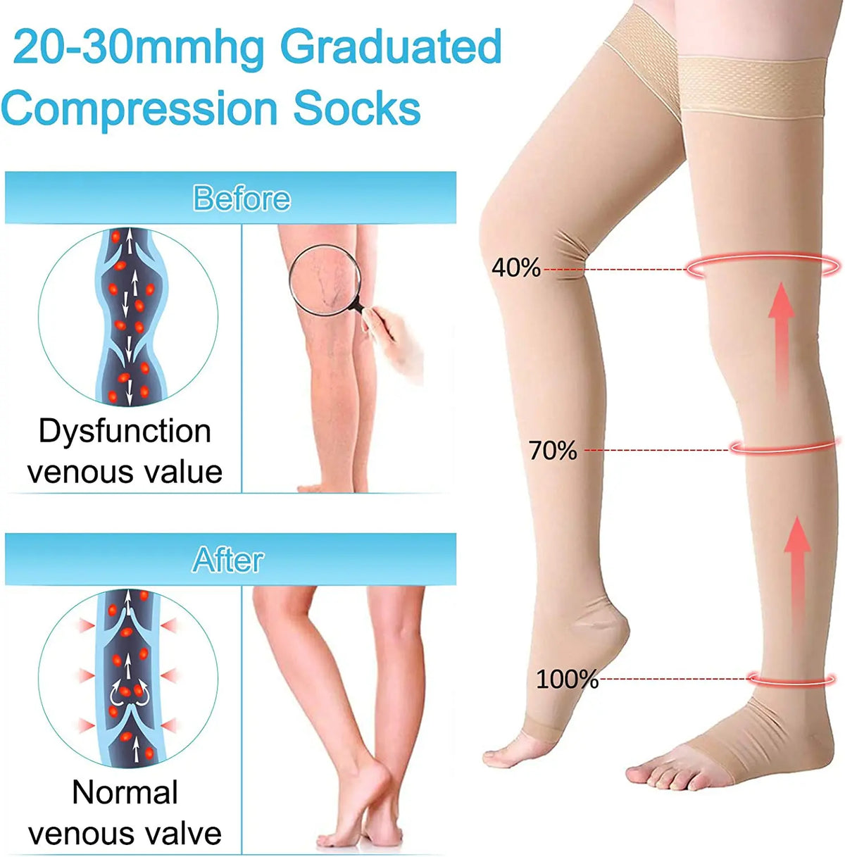 Open-Toe Compression Stockings, 30–40 mmHg