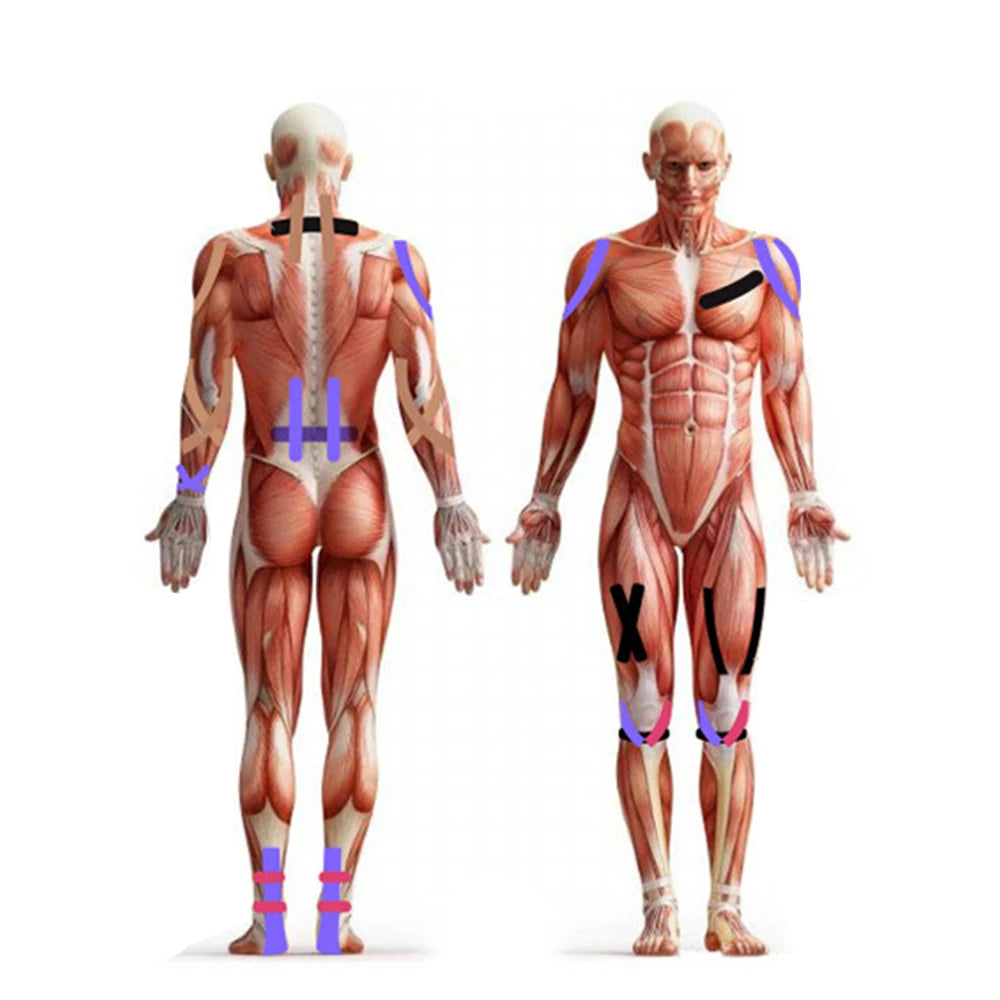 Elastic Kinesiology Tape, 5 m x 5 cm