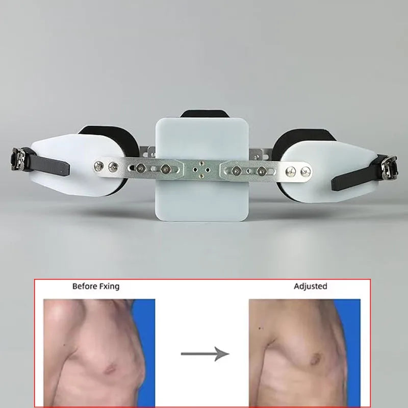 Adjustable Pectus Carinatum Orthosis Brace