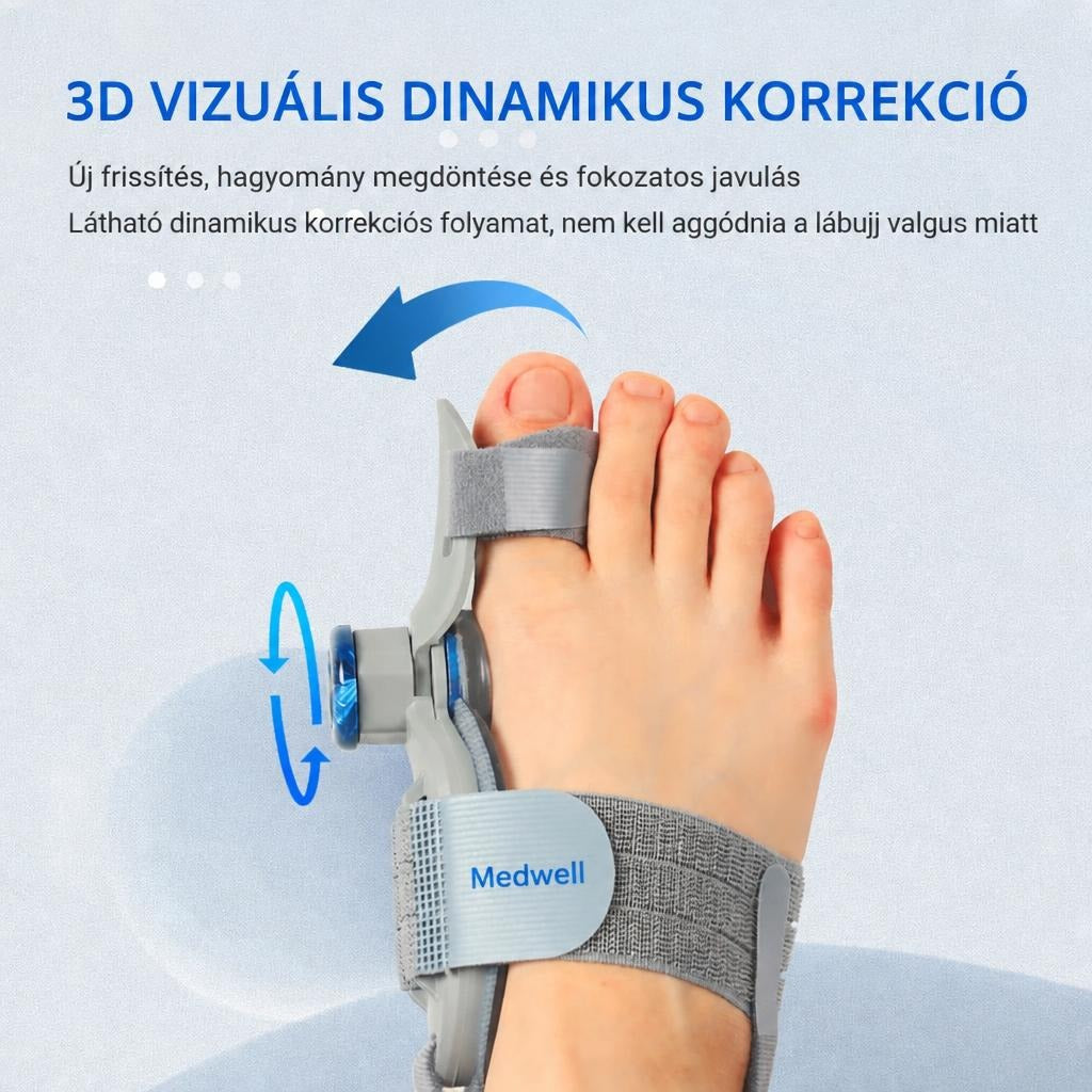 Medwell lábujj korrektor a lábfejen, 3D vizuális dinamikus korrekció bemutatása.