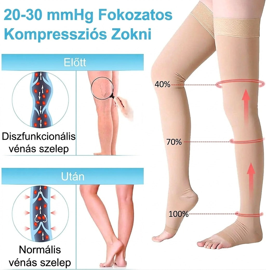 20-30 mmHg fokozatos kompressziós zokni vénás szelepmechanizmus diagaram