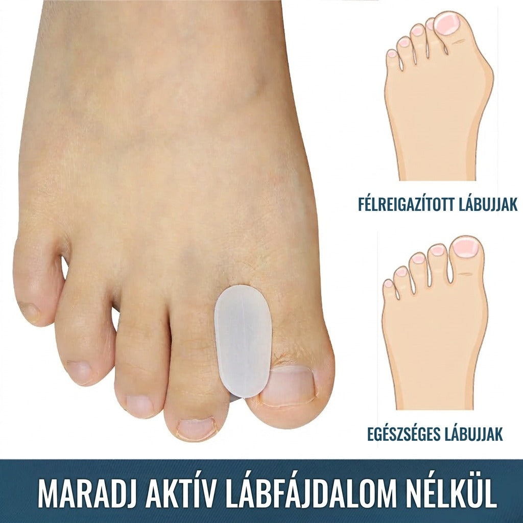 Misaligned vs. healthy toes; stay active without foot pain.